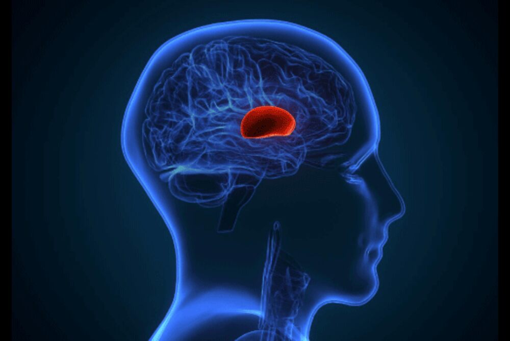 Causes of Brain Hemorrhage