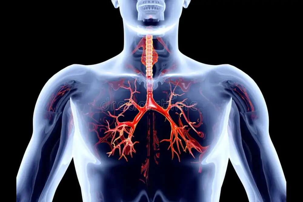 What is Bronchial Artery Embolization