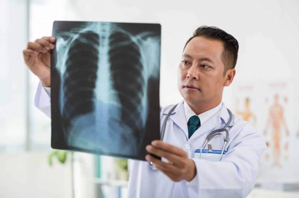 Causes of Pleural Effusion