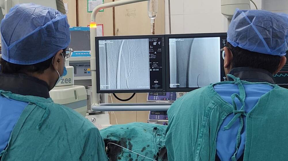 GAE procedure in progress with Dr Sandeep overseeing the embolization treatment
