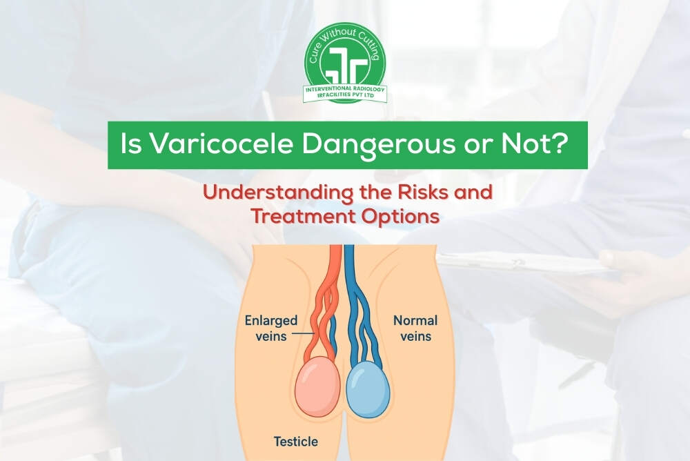 Is Varicocele Dangerous or Not Understanding the Risks and Treatment Options
