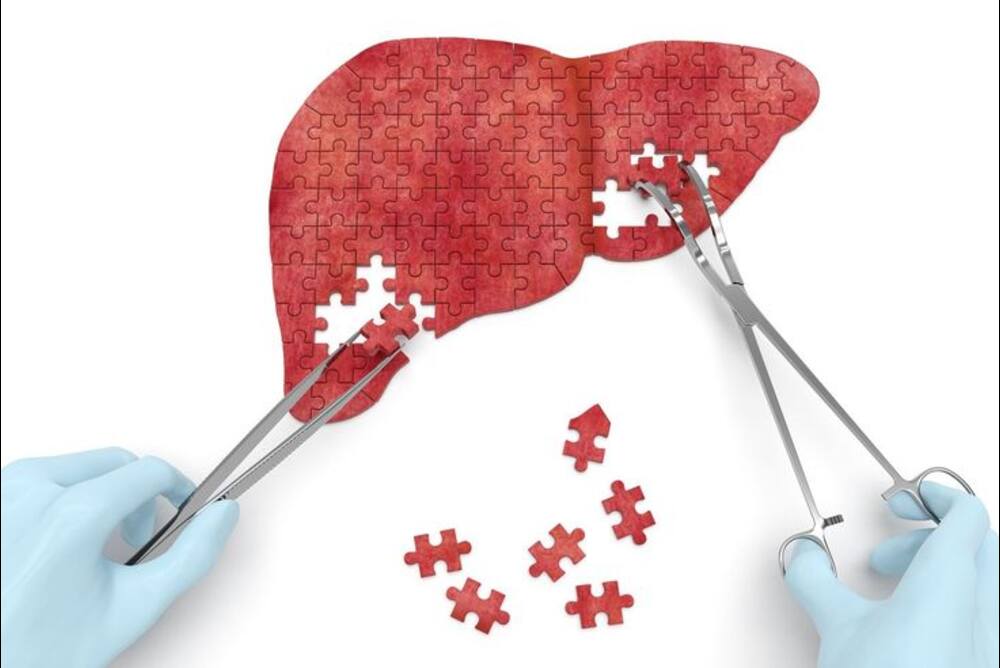 Liver Abscess Treatment Cost Recovery Time