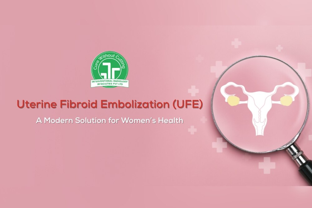 Uterine Fibroid Embolization UFE A Modern Solution for Womens Health