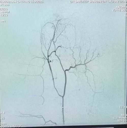 Descending genicular artery