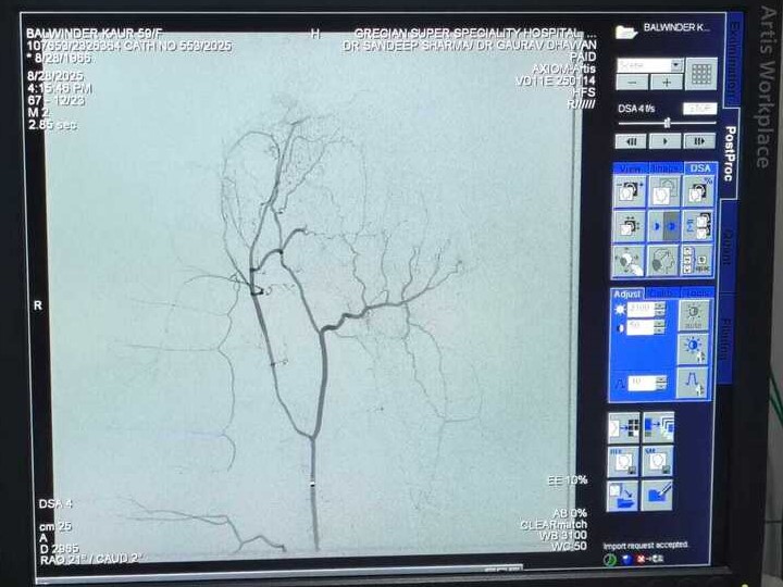 Descending genicular artery