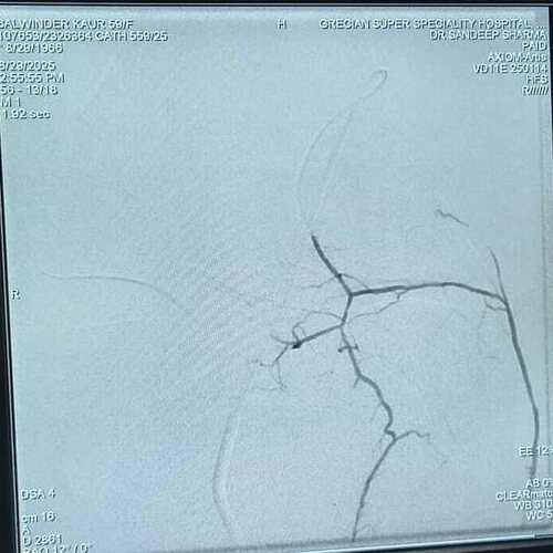Recurrent genicular artery