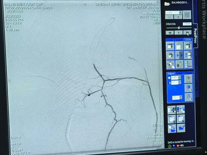 Recurrent genicular artery