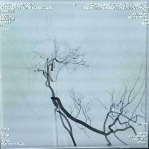 Superior medial genicular artery