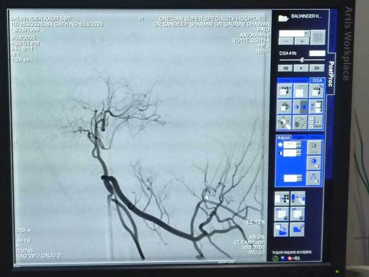 Superior medial genicular artery